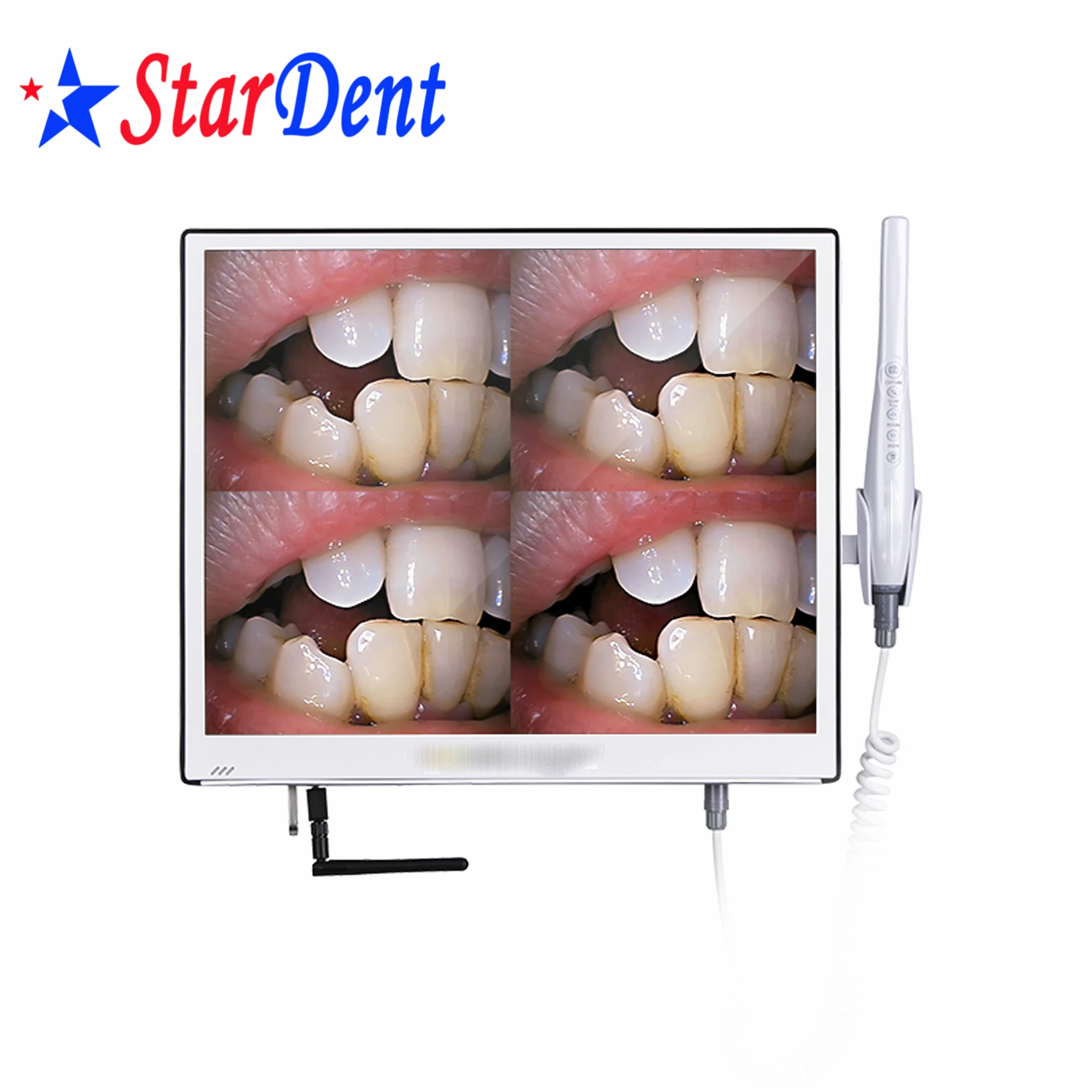 

Dental Equipment Embedded Operating System Dental WIFI Intraoral Camera 17 Inch Screen Automatic Adjustment