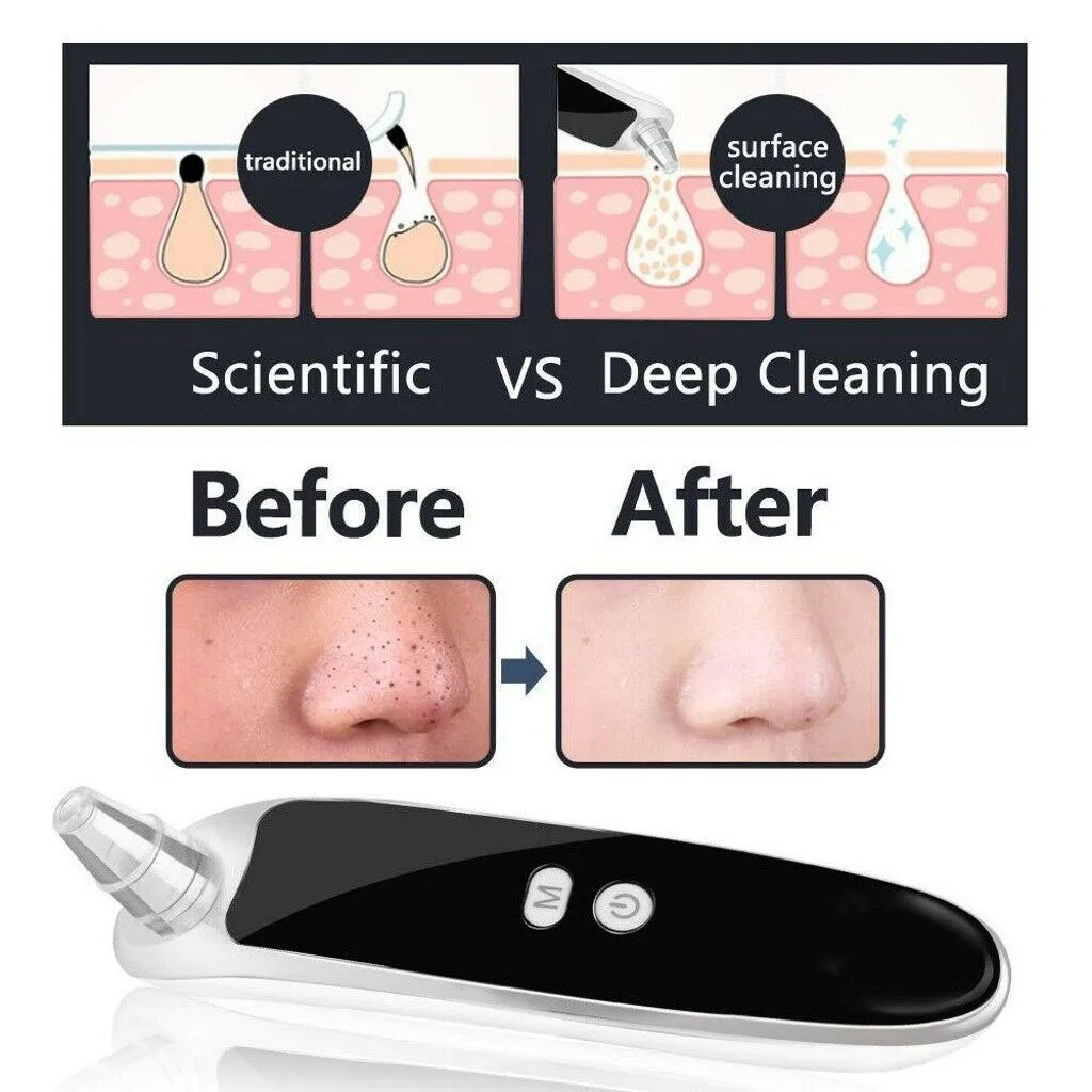 

New Electric Blackhead Remover Blackhead Anti Acne Vacuum Cleaner Pore Skin Care Tools Nose Face Deep Cleansing Suction Machine