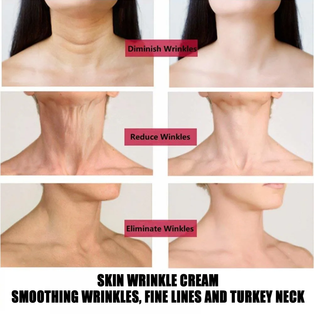 Neck Firming Wrinkle Remover Cream Rejuvenation Skin Whitening Moisturizing Shape Beauty Care Products | Красота и здоровье