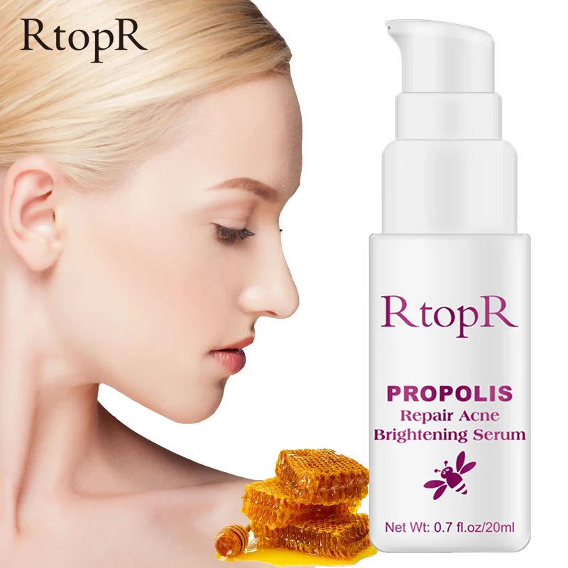

RtopR Propolis Anti-acne Essence Rich in Vitamin E And Mango Extract Gentle Acne Treatment Acne Marks Whitening Moisturizing