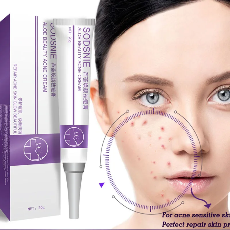 

Aloe Acne Treatment Cream Pimple Acne Mark Blackhead Removal Moisturizing Oil Control Face Gel Herbal Anti Acne Repair Skin Care