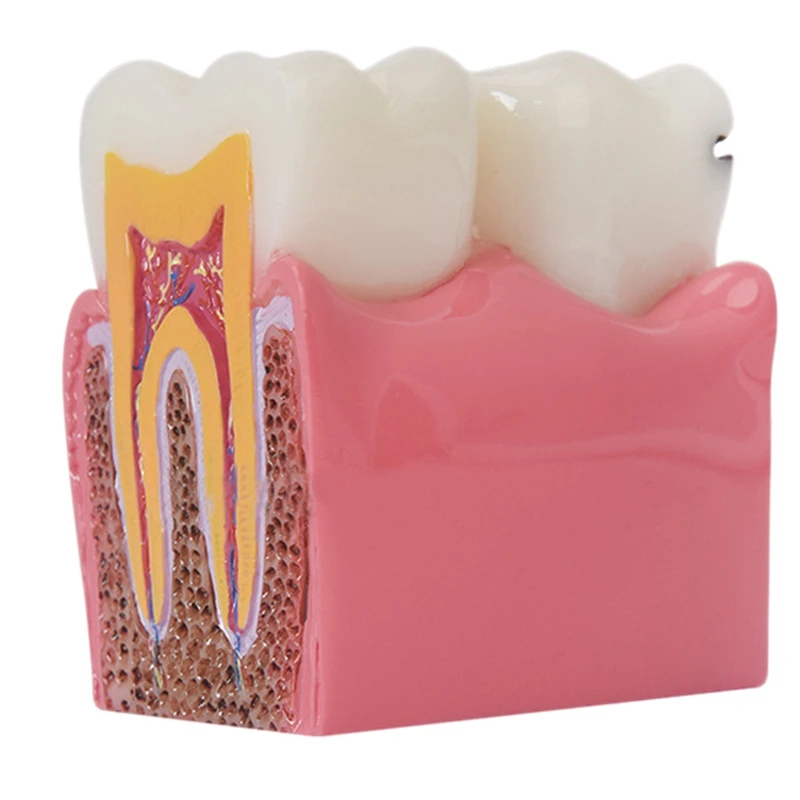 

Модель зубов, материалы, лабораторная модель зубов, 6 раз, кариес, исследования моделей для стоматолога, изучение и исследование