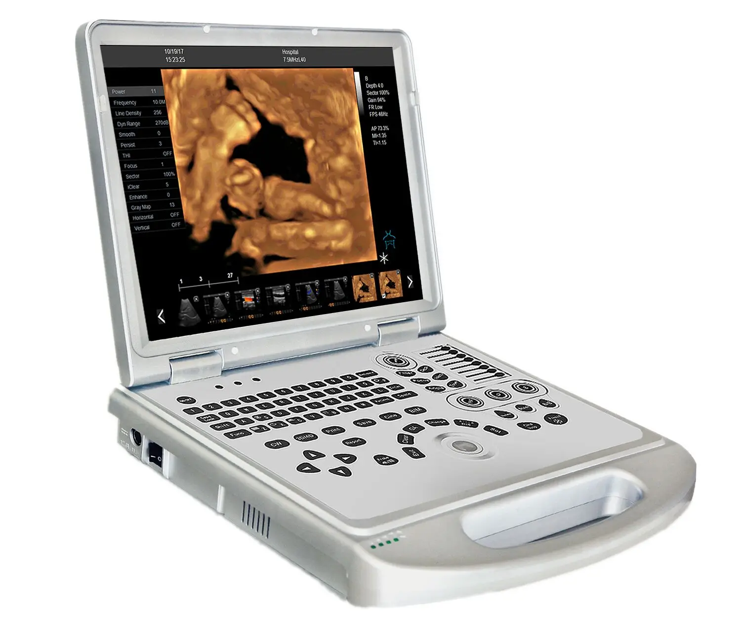 Аппарат цветной. P11 Plus Portable Colour Doppler Ultrasound System. Сканер для ноутбука.