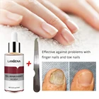 Эссенция LANBENA для восстановления ногтей, педикюра, паронихии, грибковых атак, потрескавшегося грубого обесцвечивания ногтей, разделения ногтей, ухода за ногтями на ногах