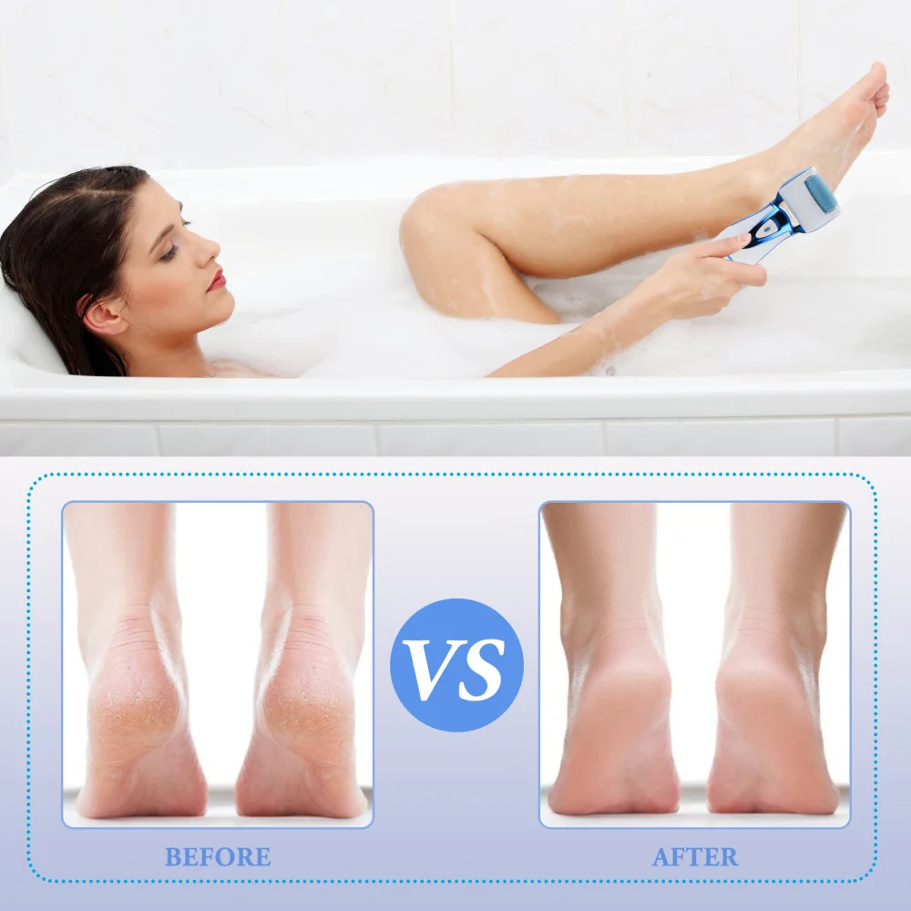 

1 Set Practical Foot File Electric Foot Grinder Pedicure Callus Removing Tool