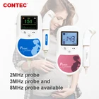 Фетальный допплер CONTEC Baby sound C C1 + гель