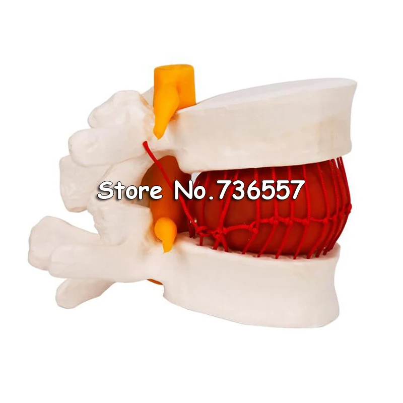 Человеческая планшетологическая грыжа обучающая модель мозга черепа