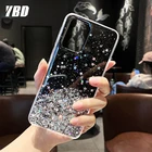 YBD Прозрачный блестящий чехол для Samsung Galaxy A51 A71 A81 A91 A50 A70 A10 A20 A50S A30S A70S A10E A20E