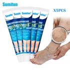 Крем для лечения варикоза, васкулит, флебит, паук, мазь для удаления варикоза, ангиит, из трав, медицинская пластырей, 20 г, 5 шт.