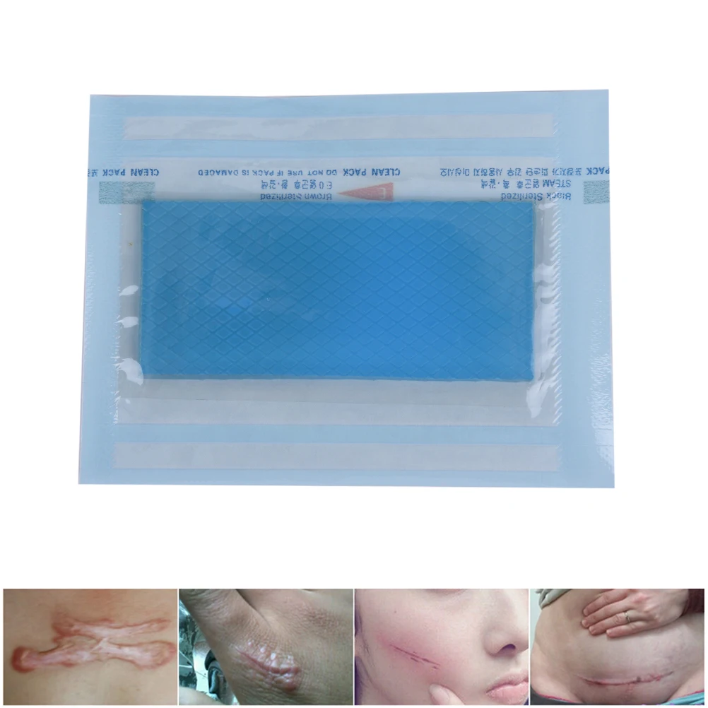 3.5*7cm Silicone Removal Patch Reusable Acne Gel Scar Therapy Silicon Remove Trauma Burn Sheet Skin Repair | Красота и здоровье