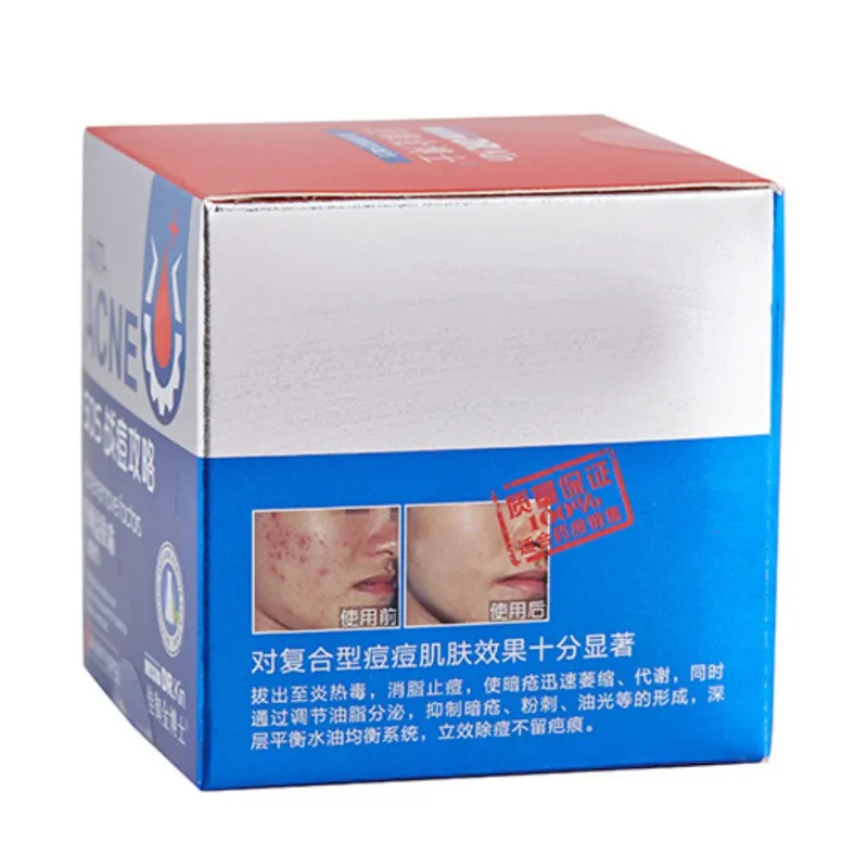 1 шт. крем для красоты акне прокол лапша удаления и анти точечный дневной