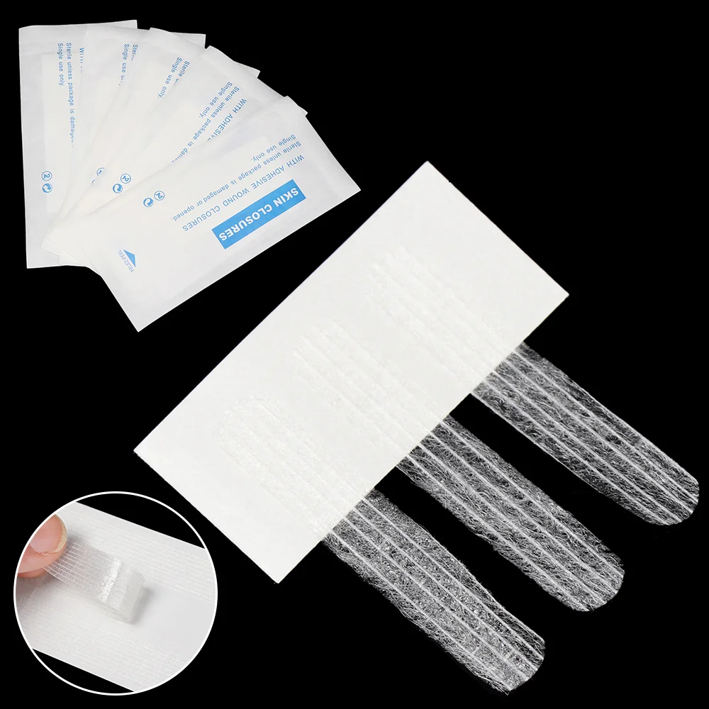 1 упаковка полоски для ран на кожу хирургическая Послеродовая Тяговая плотная