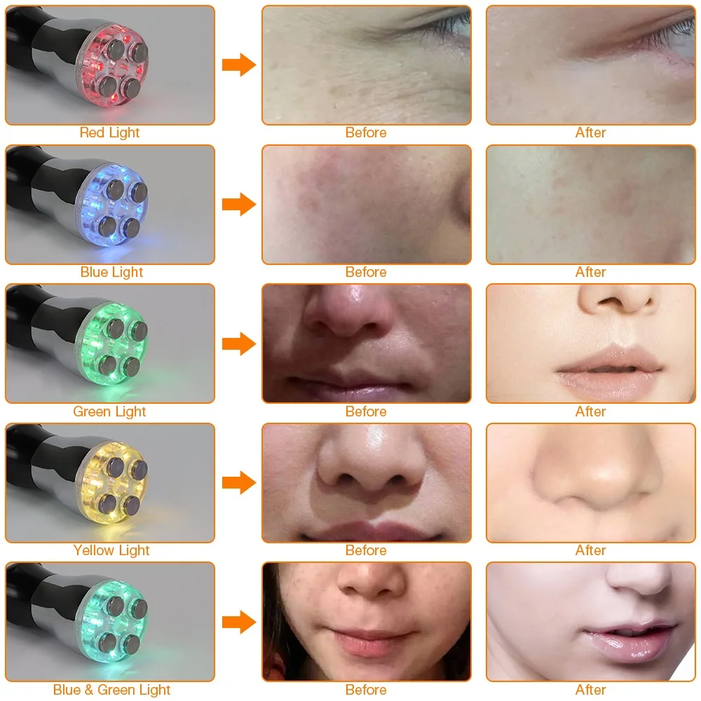 Радиочастотный светодиодный массажер для лица Photon мезотерапия микротоковое