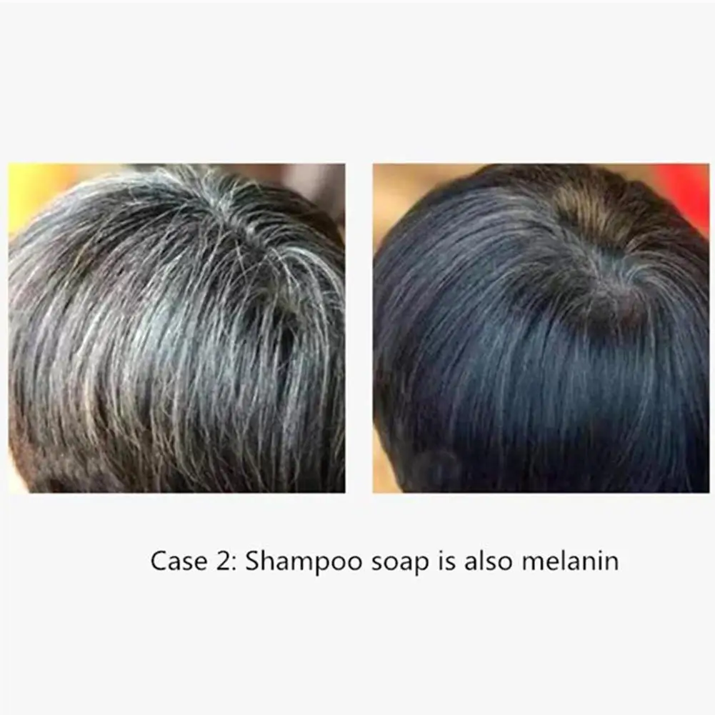 

Hair Darkening Shampoo Handmade Soap Nourishing Hair Roots Oil Essential Softening Care Control Soap S Scalp Oil Cleansing C5K8