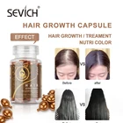 Sevich 30 штбутылка для роста волос капсулы имбирь роста волос Vintamin капсулы анти-потеря для лечения истончение волос уход за волосами