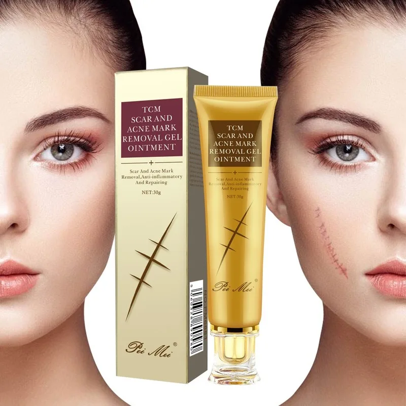 

30g Ance Scar Removal Cream Acne Scars Gel Stretch Marks Surgical Scar Burn For Body Pigmentation Corrector Care