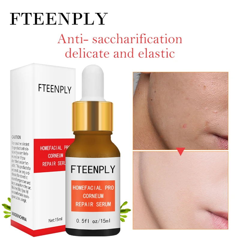 FTEENPLY Nicotinamide Сыворотка для лица Отбеливание и осветление гиалуроновой кислоты эссенция увлажняющая Антивозрастная усадка уход за поры кожи