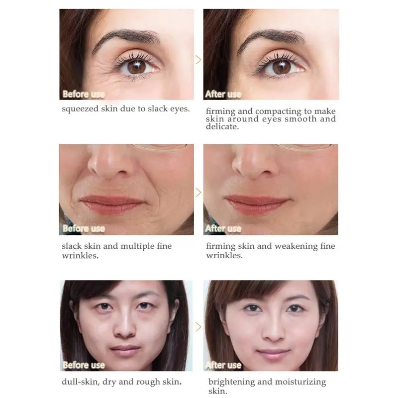 Пептидный крем для лица против морщин старения лифтинг отбеливание обеспечивает