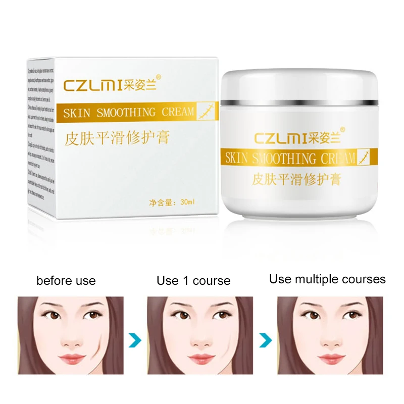 

Maternity Skin Body Cream Stretch Marks Remover And Fade Scars Postpartum Obesity Pregnancy Face Cream Skin Care TSLM1