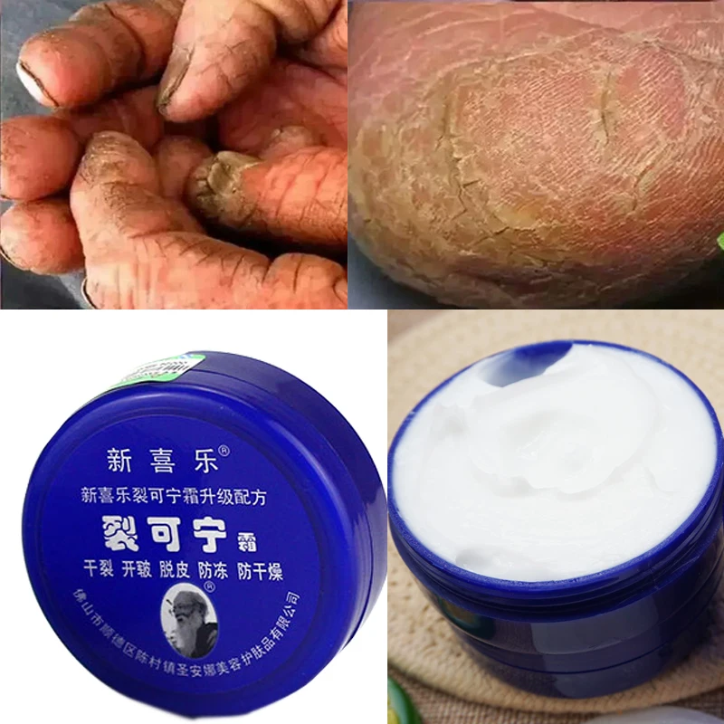 

Traditional Chinese 33g Oil Anti-Drying Crack Foot Cream Heel Cracked Repair Cream Removal Dead Skin Hand Feet Care