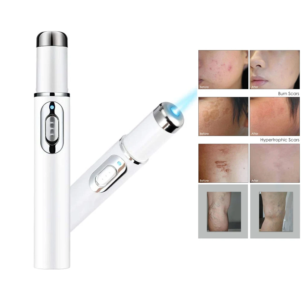

Blue Light Therapy Varicose Veins Treatment Laser Pen Soft Scar Wrinkle Blemish Dead Skin Removal Face Massage Acne Laser Pen