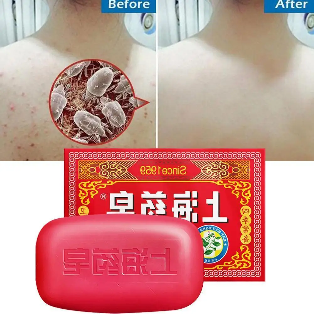 

Sulfur Soap Bathing Cleaning Bar Soap Acne Treatment Remover Blackhead Whitening Cleanser Oil-control Soap X7m7