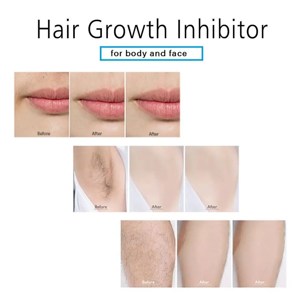 

1Pcs Permanent Hair Growth Removal Inhibitor Spray Beard Bikini Intimate Legs Body Armpit Painless Stop Hair