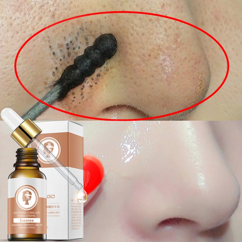 30 мл гиалуроновая кислота Усадочные поры лица сыворотка против старения