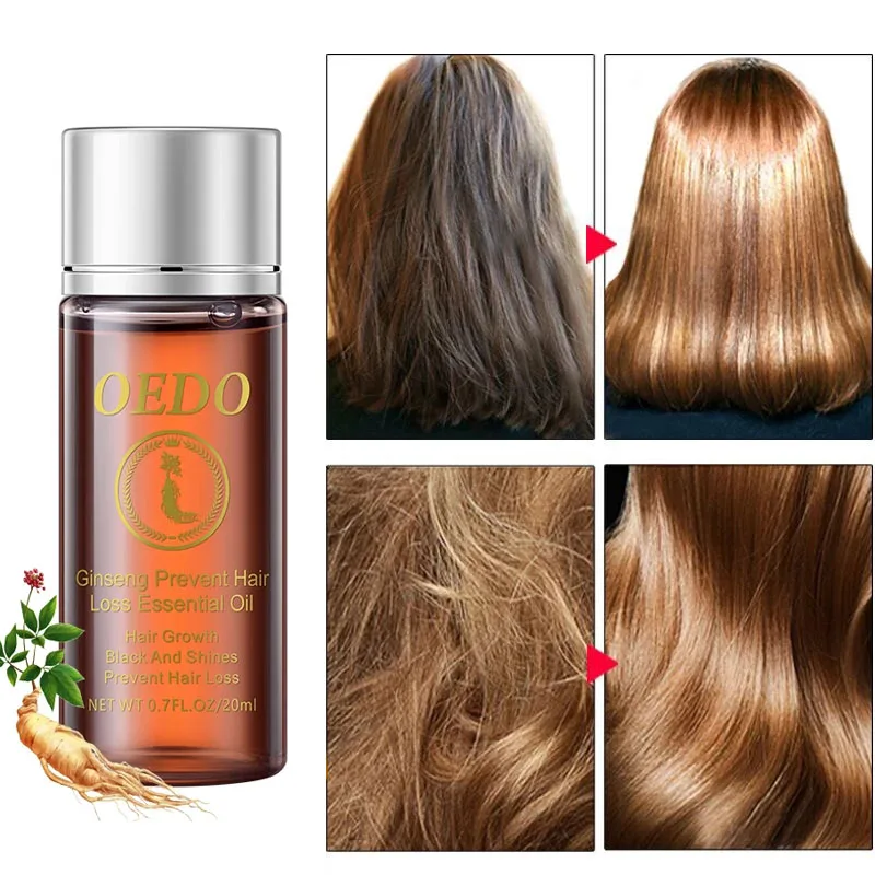20 мл эфирное масло женьшеня для предотвращения выпадения волос стимулирует рост