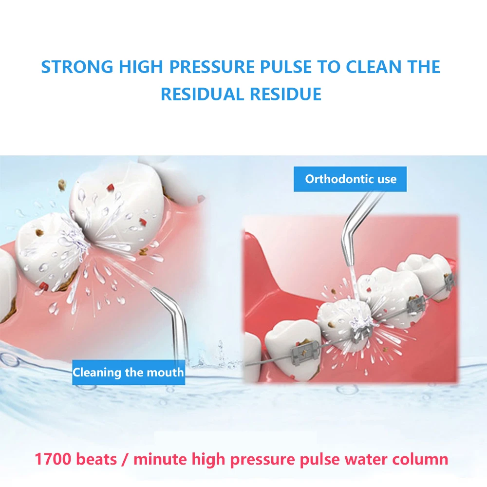 USB ирригатор для полости рта с аккумулятором 300 мл|Ирригаторы рта| |