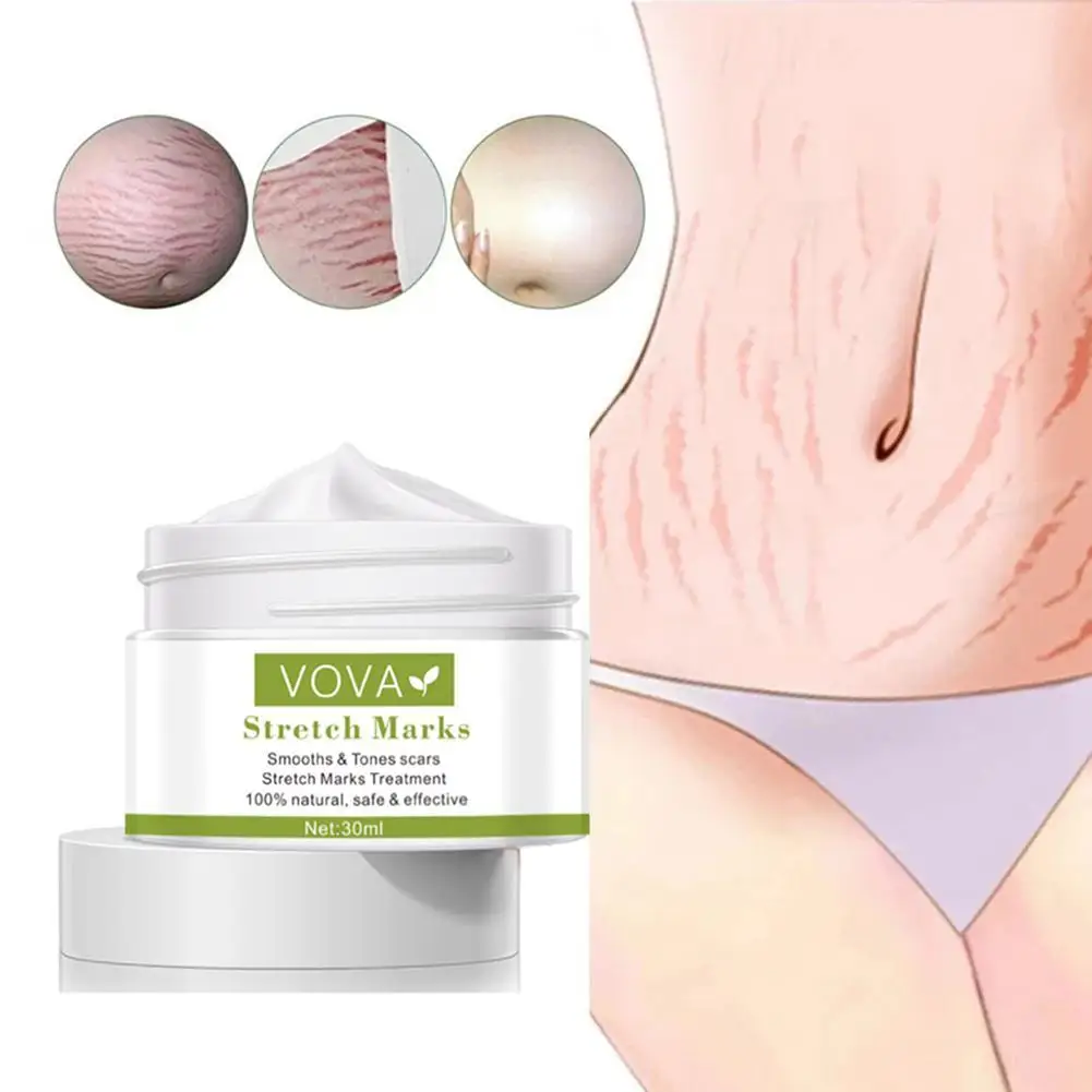 

Effective Remove Pregnancy Scars Acne Cream Stretch Marks Treatment Maternity Repair Anti-Aging Anti-Winkles Firming Body Creams