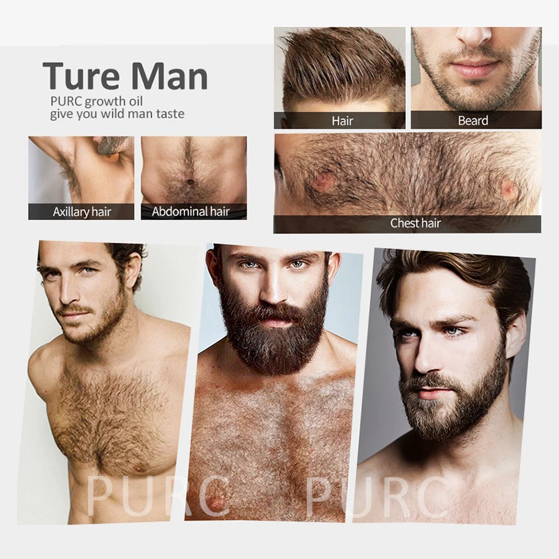 Мыло ручной работы эссенция для роста волос и бороды против выпадения зуда сухой