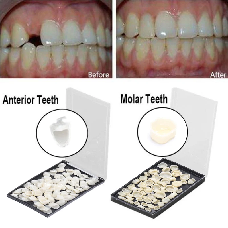 1 коробка стоматологические временные зубные короны задние и полимерные