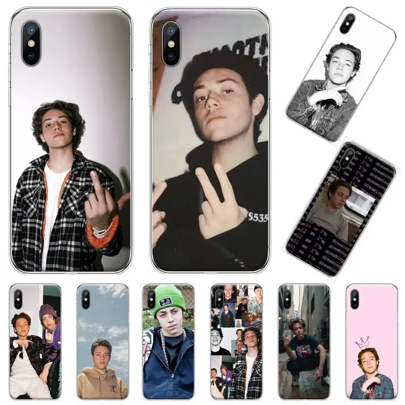 

Carl Shameless actor Phone Case Transparent soft For iphone 12 11 13 7 8 6 s plus x xs xr pro max mini