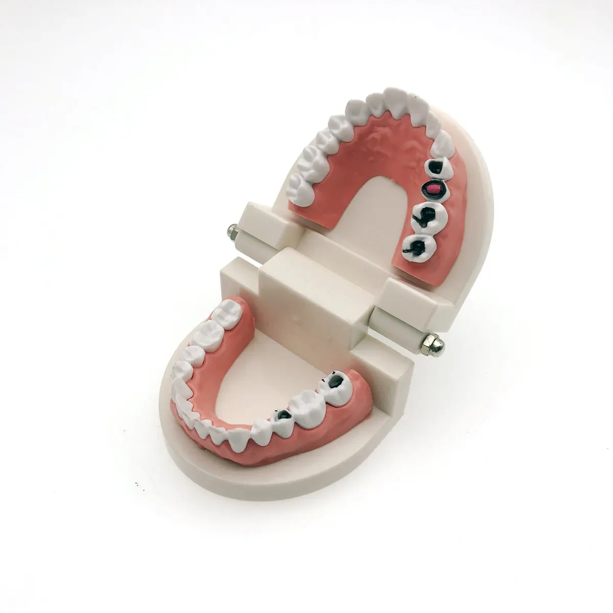 Модель для обучения стоматологии кариеса модель демонстрация размер