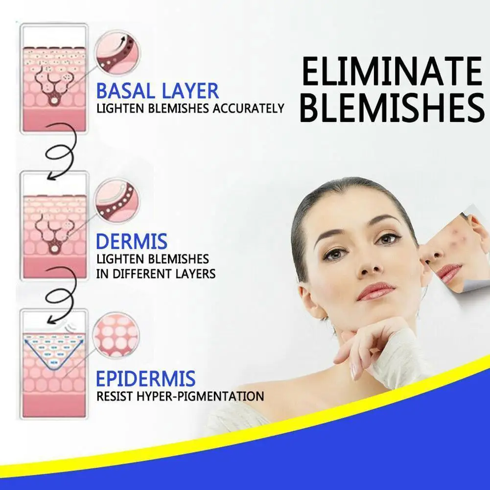 

30g White Spot Antibacterial Cream Spray Medical Pigment Treatment Promoting Melanin Vitiligo Skin Liniment Disease Leukopl K1C5