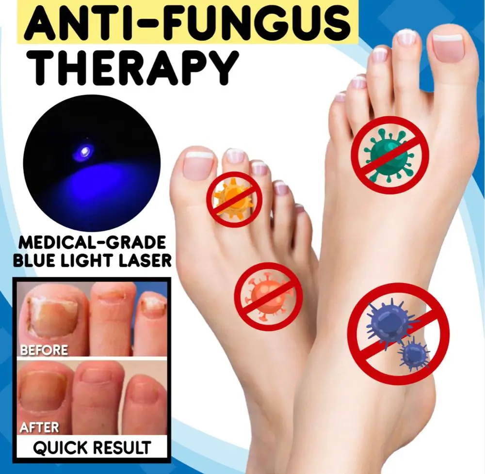 Anti-fungal Home Treatment Set Toe Nail Pen Onychomycosis Paronychia Anti Fungal Fungus Care Repair Serum Kit | Красота и здоровье