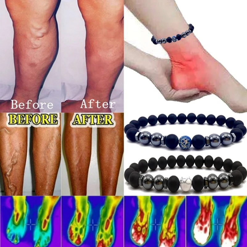 Weight Loss Magnet Anklet Colorful Stone Magnetic Therapy Bracelet Product Slimming Health Care jewelry | Украшения и аксессуары