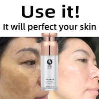 high quality remove the spots make the skin smooth delicate reduce the wrinkles retrench the face safe and effective chloasma