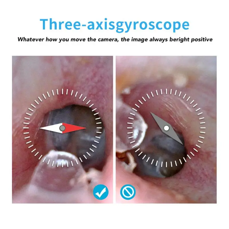 Wifi Smart Otoscope Earscope Cleaner Ear Spoon Earpick 3.9mm Endoscope Camrea | Инструменты