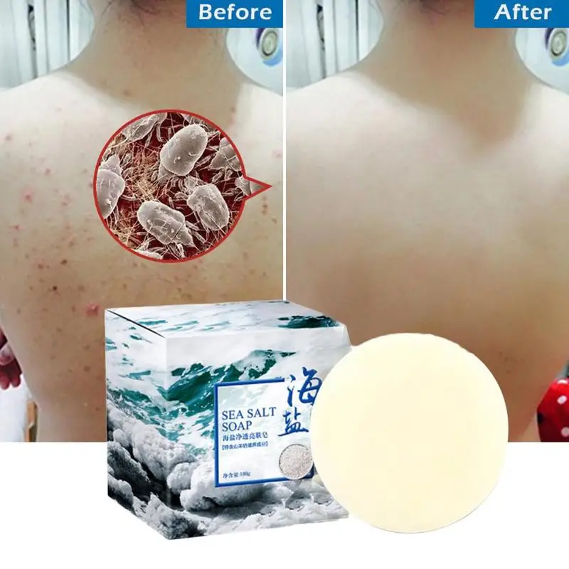 100 г морская соль мыло Удаление прыщей поры лечение акне козья кожа увлажняющий
