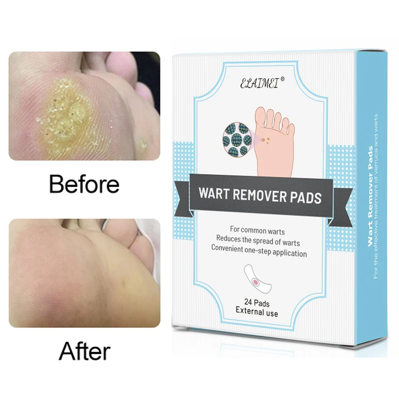 

Wart Remover Pads Curative Patches Removal Pad Warts Thorn Corns Calluses Medical Patch Relieve Pain Healthy Foot Care 24Pcs/Box