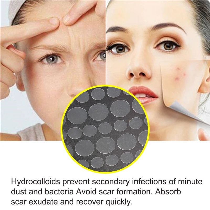 36 шт./1 мешок патчи от акне Гидроколлоидные прыщи точки невидимое точечное