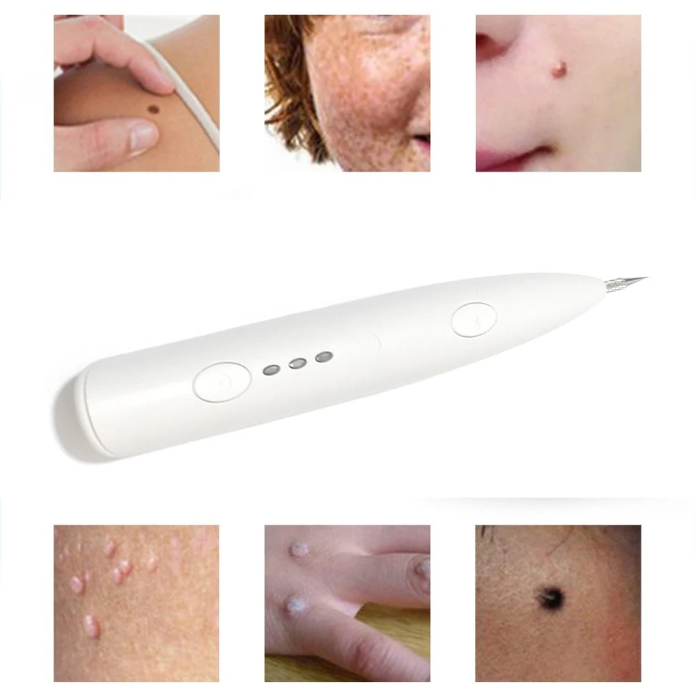 

Laser Plasma Pen Mole Removal Dark Spot Remover LCD Skin Care Point Pen Skin Wart Tag Tattoo Removal Tool Beauty Care Drop Ship