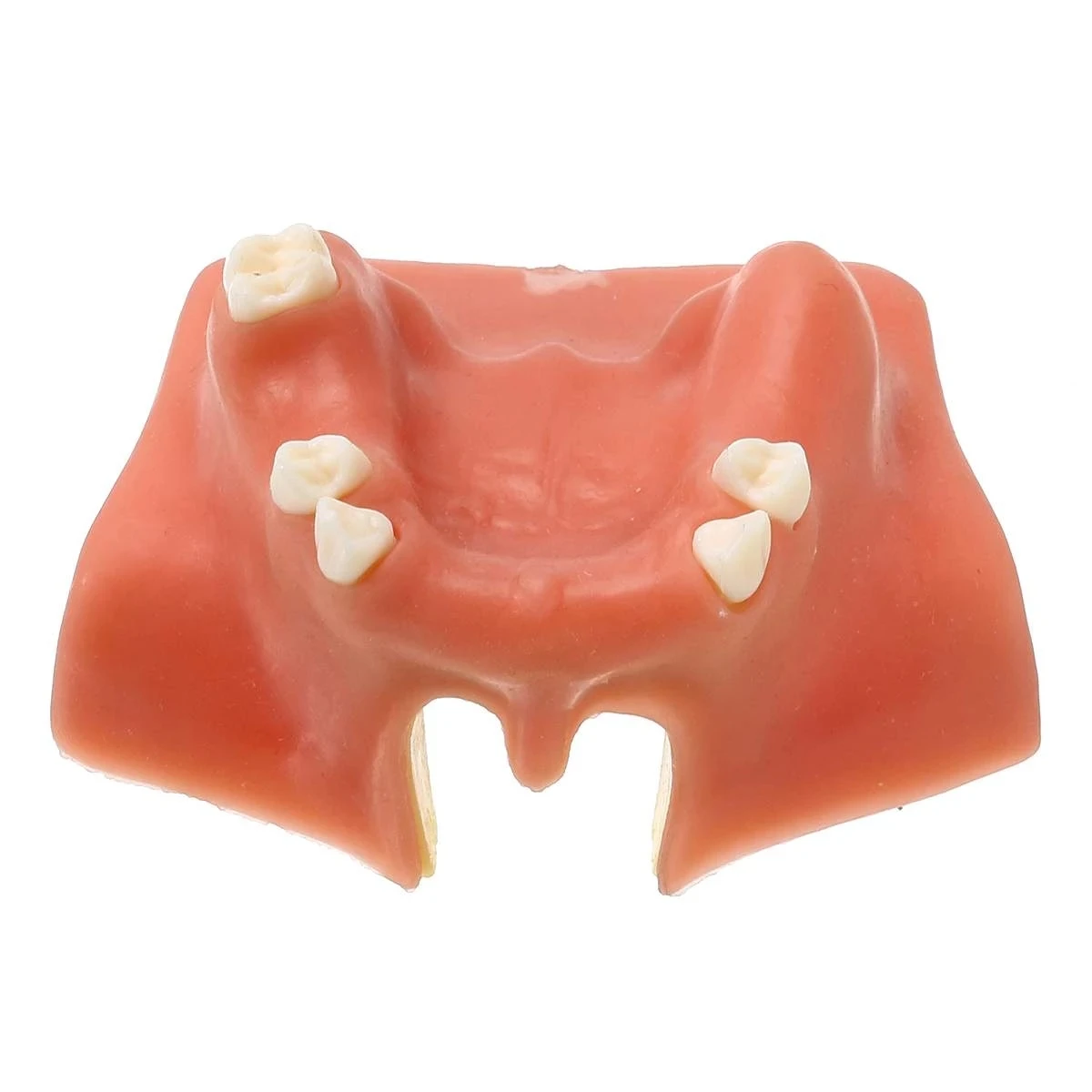 

1pcs Resin Maxillary Teeth Model Upper Jaw Sinus Lift Implants Restoration Dental Practice For Medical Teach Study Demonstration
