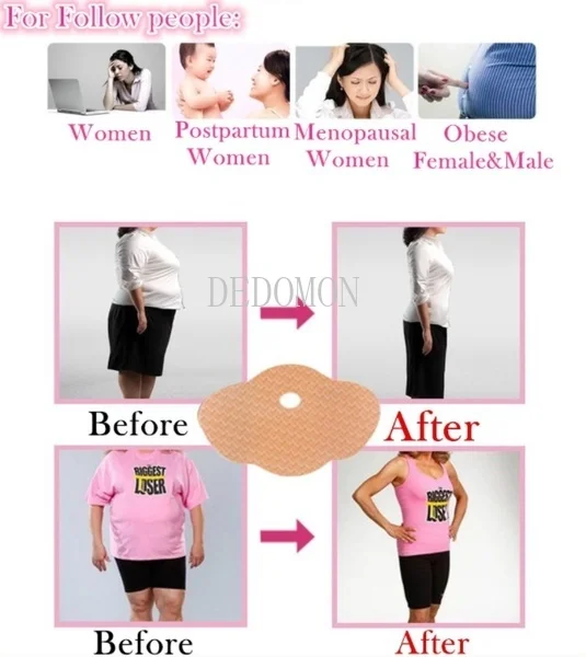 10 шт. пластырь для похудения пластыри сжигания жира Мими чудо живота Женский