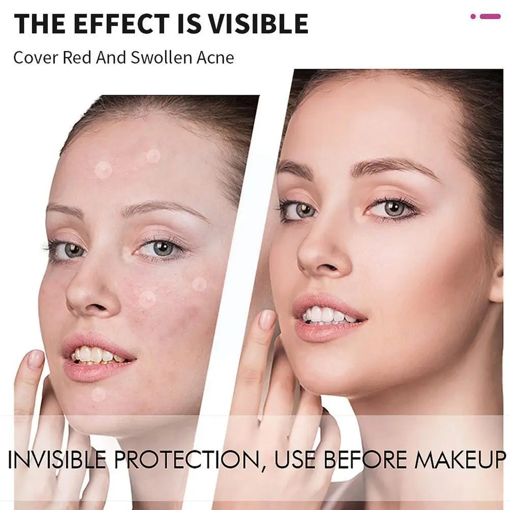 

RtopR Invisible Acne Patch Waterproof Skin Label Acne Removal Care Removal Spot Mask Patch Facial Spot Facial O3Q1