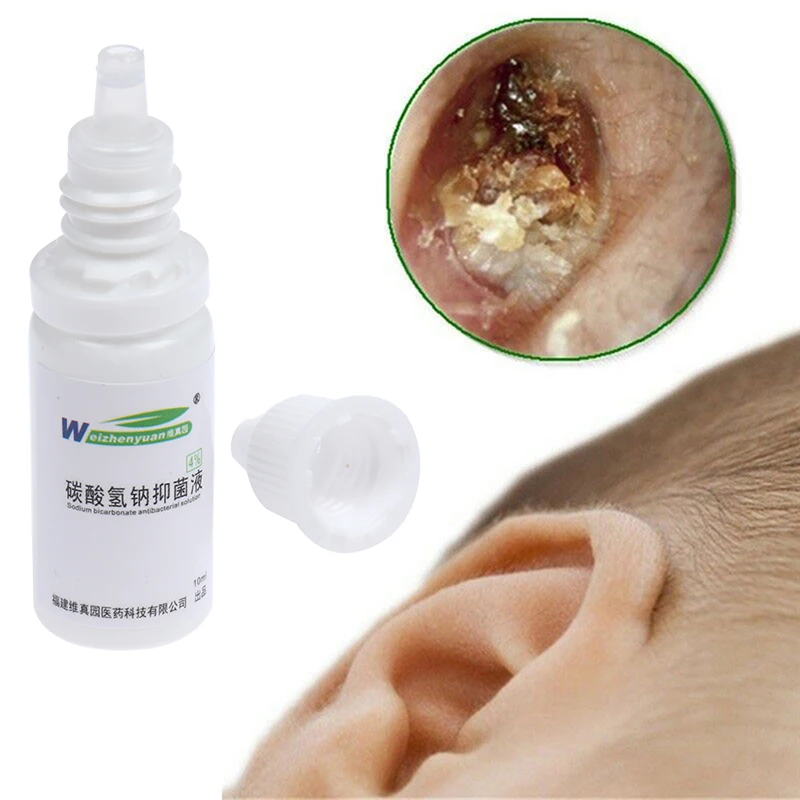 

Капли для ушей 10 мл, бикарбонат натрия, фрикарбонат, жидкость для лечения острого и хронического отита в ушах, масло для ушей для ухода за здо...