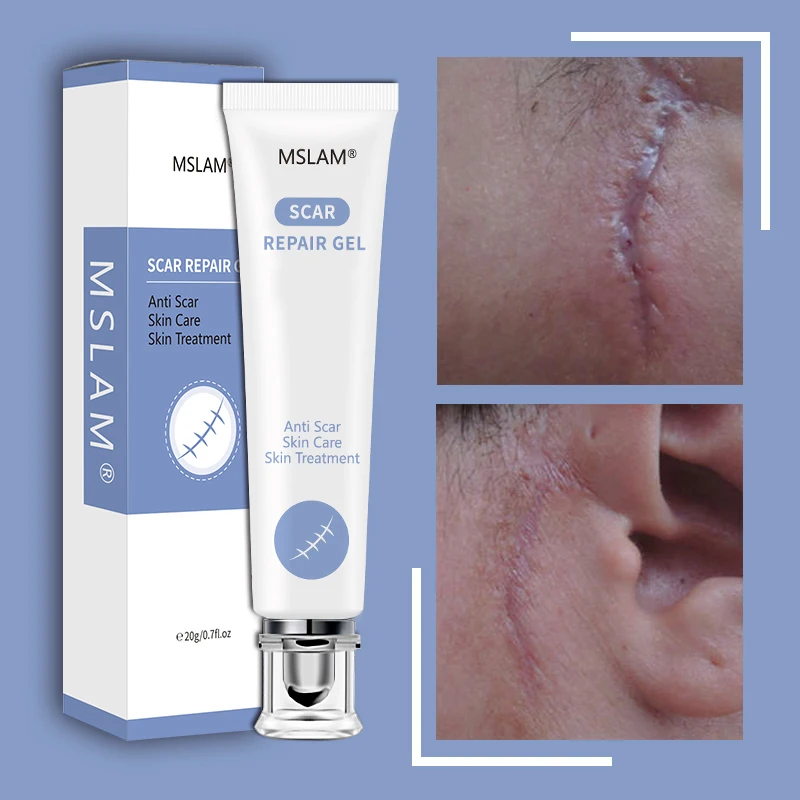 

MSLAM ремонт шрамов гель удаление шрамов акне крем лечение следов для лица корректор пигментации тела на кожу
