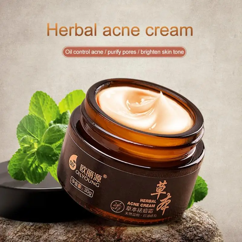 Натуральный травяной крем против акне прыщей шрамов от увлажняющий для удаления